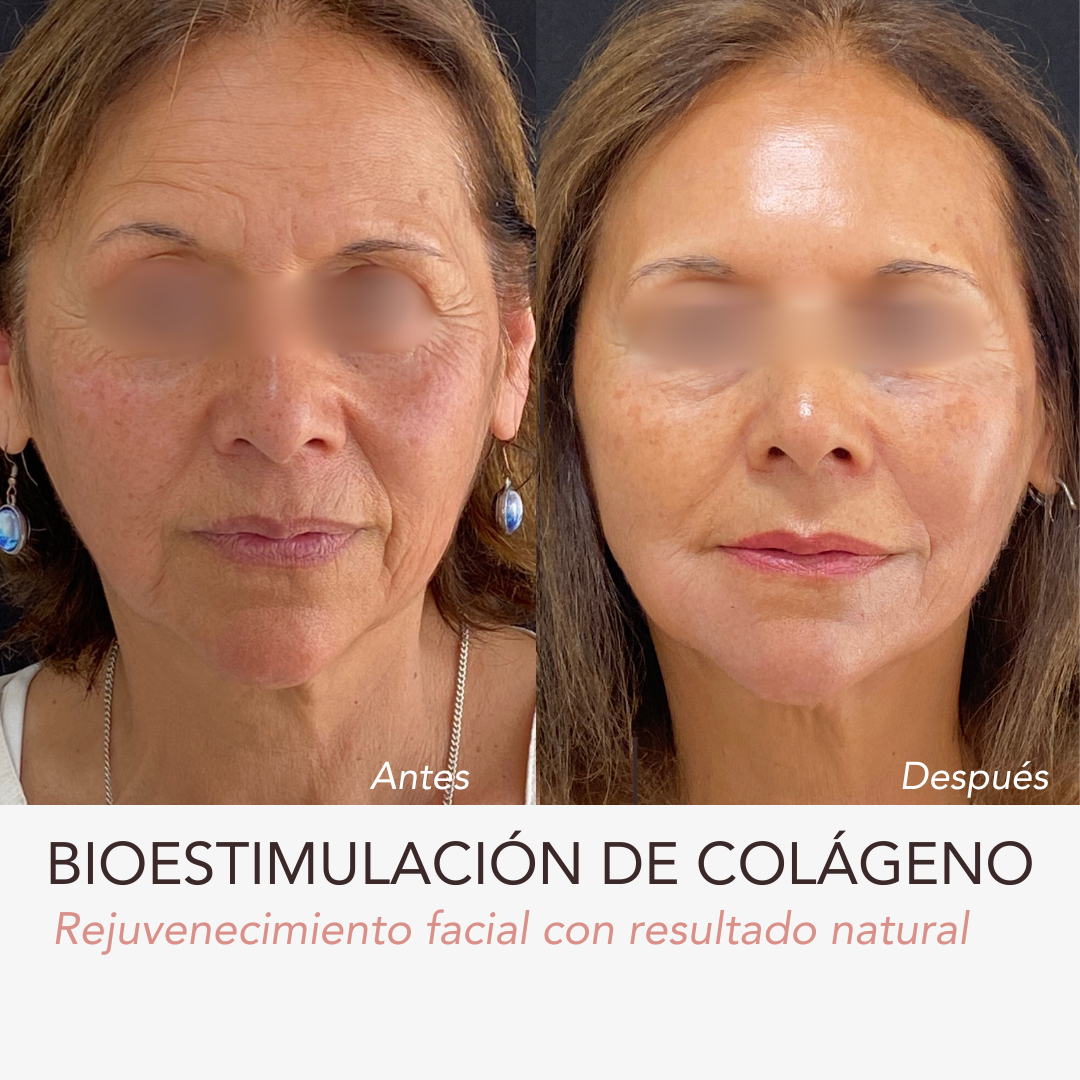 grandes resultados