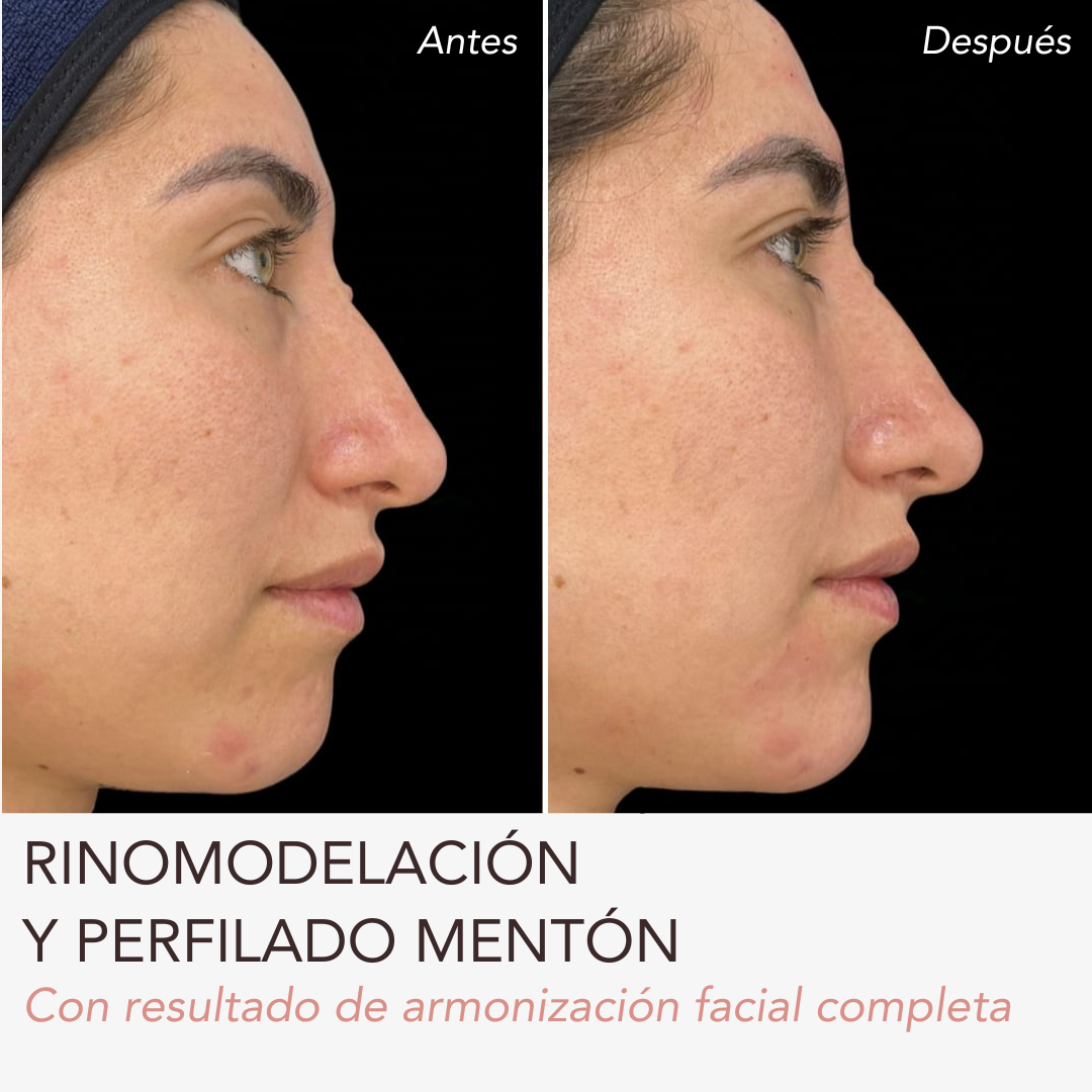 grandes resultados
