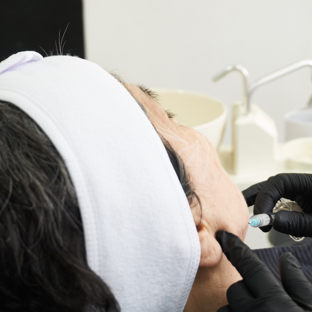 tratamiento rejuvecinimiento facial