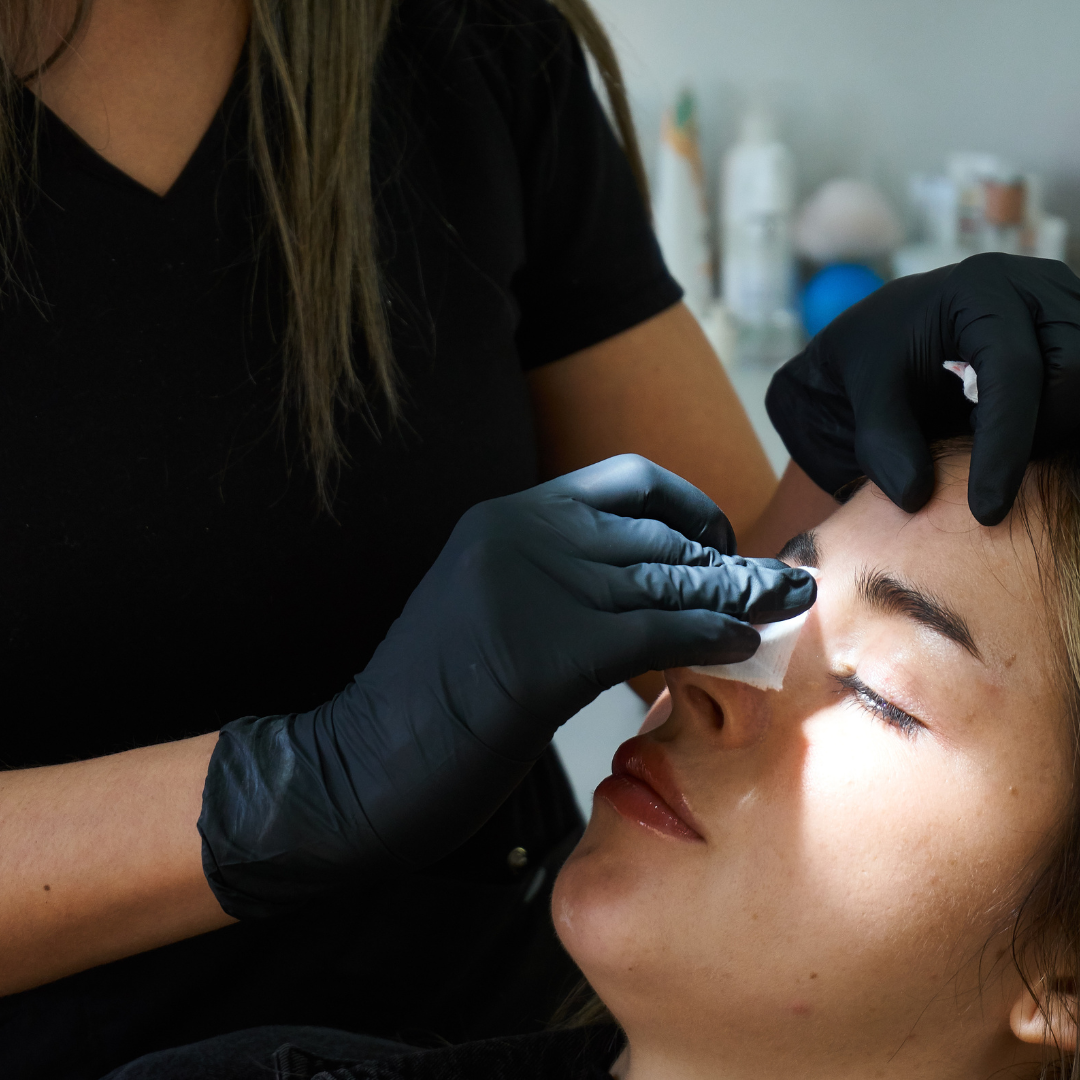 tratamiento toxina botulínica